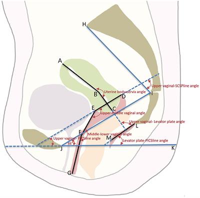 Comparison of the Axes and Positions of the Uterus and Vagina Between Women With and Without Pelvic Floor Organ Prolapse